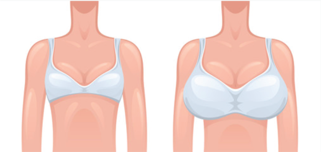 36c Bra Size Example Off 74 Medpharmres Com